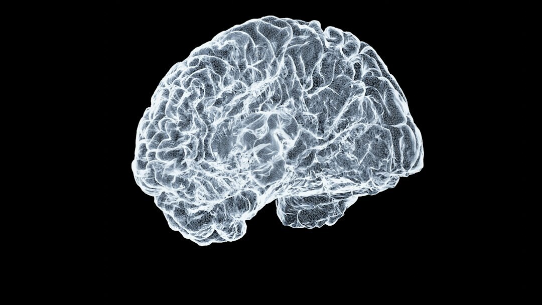 brain scan image